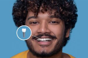 Dental Implants in Winter Garden